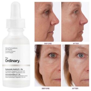 سرم آبرسان هیالورونیک اسید 2% + B5 اوردینری اورجینال Ordinary